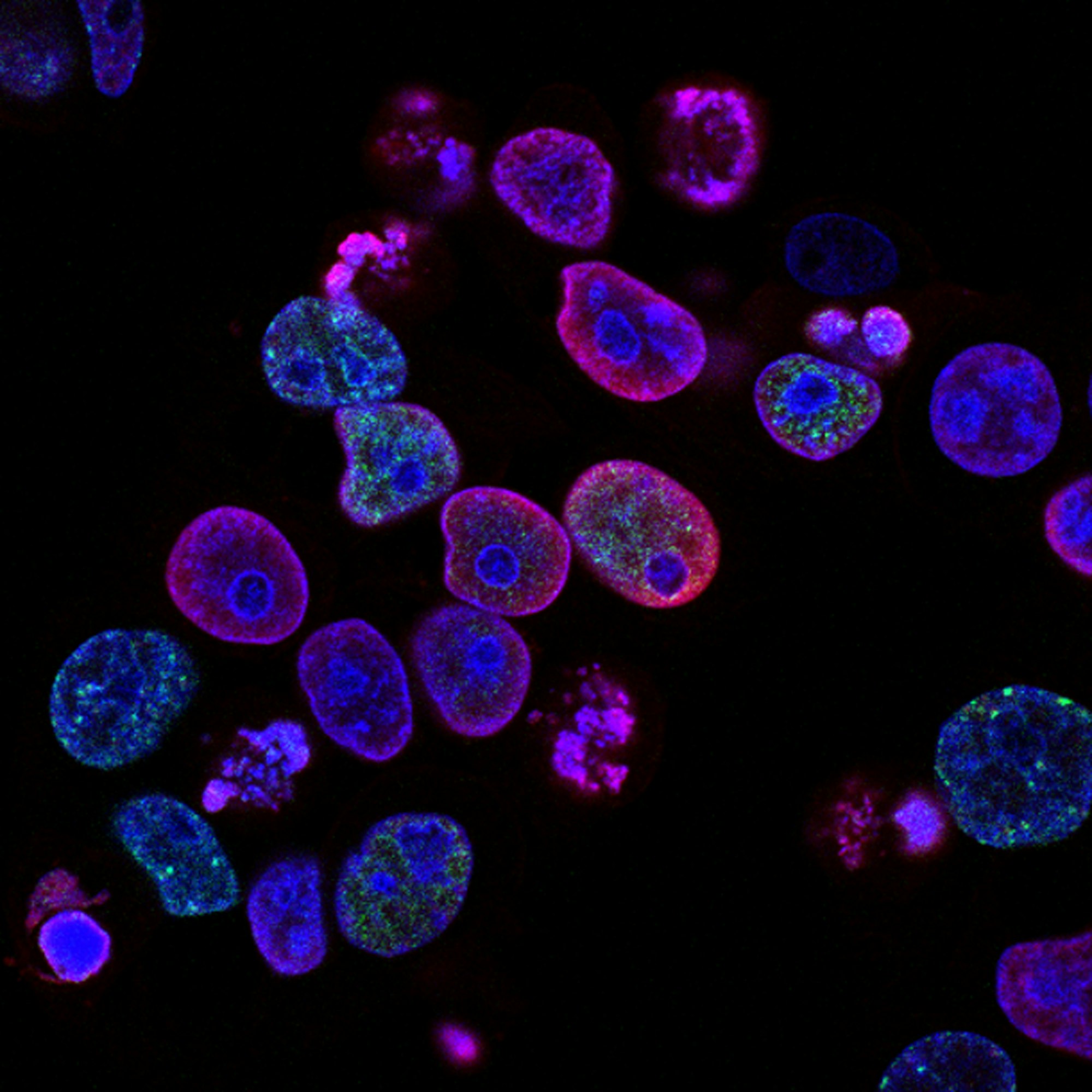 Fluorescence microscopy of cultured cells